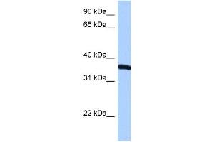 RPLP0 antibody used at 0. (RPLP0 anticorps  (N-Term))