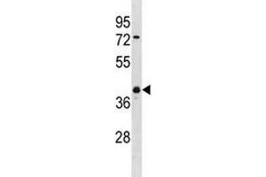 UCHL5 antibody western blot analysis in NCI-H460 lysate. (UCHL5 anticorps  (AA 136-164))