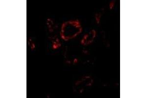 Immunofluorescence of Slug in human kidney tissue with this product at 20 μg/ml. (SLUG anticorps  (Center))