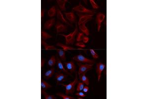 Immunofluorescence (IF) image for anti-Plakophilin 2 (PKP2) antibody (ABIN1876693)