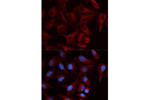 Immunofluorescence (IF) image for anti-Plakophilin 2 (PKP2) antibody (ABIN1876693) (Plakophilin 2 anticorps)