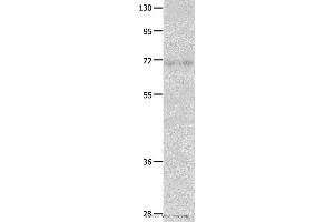 Western blot analysis of Human fetal lung tissue  , using IGF2BP1 Polyclonal Antibody at dilution of 1:500 (IGF2BP1 anticorps)