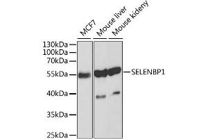 Western blot analysis of extracts of various cell lines, using SELENBP1 antibody. (SELENBP1 anticorps)