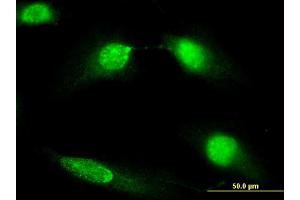 Immunofluorescence of monoclonal antibody to DIAPH3 on HeLa cell. (DIAPH3 anticorps  (AA 632-729))