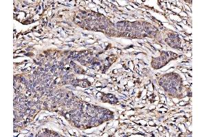 IHC analysis of PAK2 using anti-PAK2 antibody (ABIN7599219). (PAK2 anticorps  (AA 1-288))