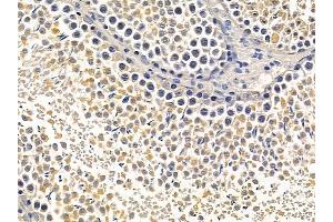 ABIN6257099 and ABIN6275623 at 1/100 staining rat testis tissue by IHC-P. (CCT5 anticorps  (Internal Region))