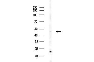 anti-Ornithine Aminotransferase (OAT) (Internal Region) antibody