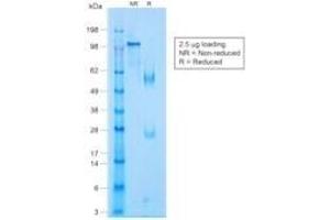 SDS-PAGE Analysis Purified p63 Rabbit Monoclonal Antibody (TP63/1423R).