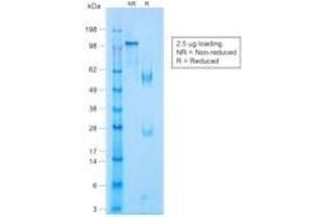 SDS-PAGE Analysis Purified p63 Rabbit Monoclonal Antibody (TP63/1423R). (p63 anticorps)