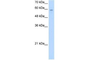 WB Suggested Anti-ARIH2 Antibody Titration:  2. (ARIH2 anticorps  (N-Term))
