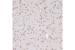 Immunohistochemistry of paraffin-embedded mouse heart using Phospho-ERK1-Y204 antibody (ABIN3019889, ABIN3019890, ABIN3019891 and ABIN1681795) at dilution of 1:100 (40x lens).