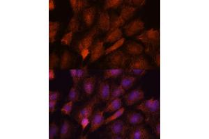 Immunofluorescence analysis of C6 cells using SMYD3 antibody (ABIN7270260) at dilution of 1:100. (SMYD3 anticorps  (AA 50-150))