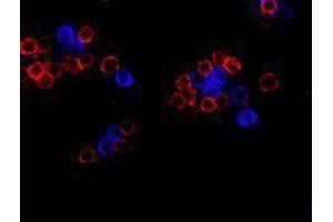 Immunofluorescence (IF) image for anti-CD19 Molecule (CD19) antibody (Alexa Fluor 647) (ABIN2657659) (CD19 anticorps  (Alexa Fluor 647))