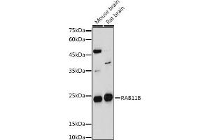 Western blot analysis of extracts of various cell lines, using RB antibody (ABIN7269795) at 1:1000 dilution. (RAB11B anticorps  (AA 130-215))