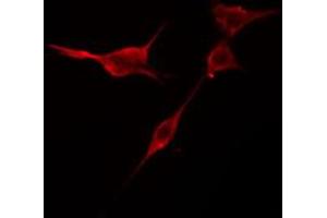 ABIN6274419 staining NIH-3T3 cells by IF/ICC. (TRIM59 anticorps  (Internal Region))