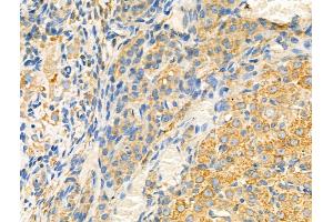 ABIN6261569 and ABIN6268794 at 1/100 staining Rat ovarian tissue by IHC-P.