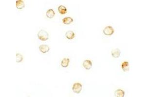 Immunocytochemistry of JMJD3 in K562 cells with JMJD3 antibody at 2.