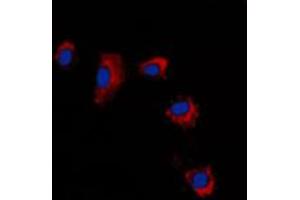 Immunofluorescent analysis of Claudin 2 staining in A431 cells. (Claudin 2 anticorps  (C-Term))