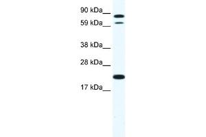 WB Suggested Anti-ZFP287 Antibody Titration:  1. (ZNF287 anticorps  (N-Term))