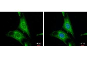 ICC/IF Image WNT10A antibody [N1C1-2] detects WNT10A protein at cytoplasm by immunofluorescent analysis.