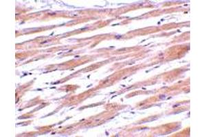 Immunohistochemistry of UNG in human heart tissue with UNG polyclonal antibody  at 2 ug/mL . (UNG anticorps  (C-Term))
