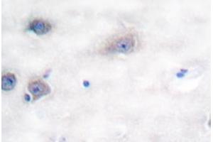 Image no. 2 for anti-Tyrosine Hydroxylase (TH) antibody (ABIN271856) (Tyrosine Hydroxylase anticorps)