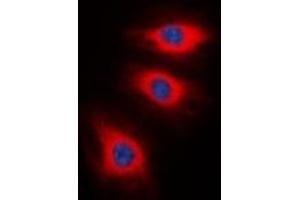 Immunofluorescent analysis of Caldesmon (pS789) staining in HeLa cells.