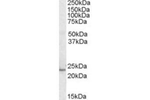 Western Blotting (WB) image for anti-Kruppel-Like Factor 16 (KLF16) (C-Term) antibody (ABIN2465875) (KLF16 anticorps  (C-Term))