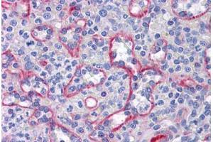 Human Spleen: Formalin-Fixed, Paraffin-Embedded (FFPE)