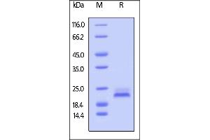 Biotinylated Human TRAIL R2, Avitag,His Tag on  under reducing (R) condition.