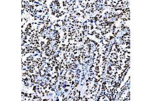 IHC analysis of HDAC2 using anti-HDAC2 antibody (ABIN7601564). (HDAC2 anticorps  (AA 387-488))