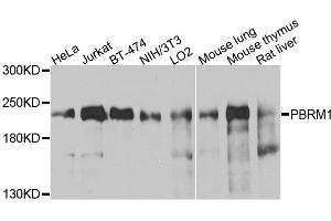 Western blot analysis of extracts of various cells, using PBRM1 antibody. (Polybromo 1 anticorps)