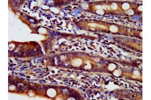 IHC image of ABIN7160878 diluted at 1:500 and staining in paraffin-embedded human small intestine tissue performed on a Leica BondTM system.