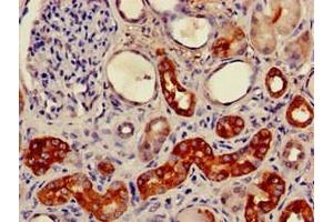 Immunohistochemistry of paraffin-embedded human kidney tissue using ABIN7153147 at dilution of 1:100 (FXR1 anticorps  (AA 469-614))