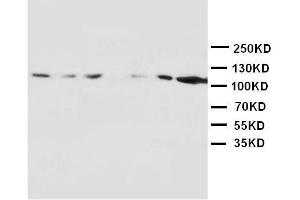 Anti-NMDAR1 antibody, Western blotting Lane 1: Rat Brain Tissue Lysate Lane 2: Rat Brain Tissue Lysate Lane 3: Rat Liver Tissue Lysate Lane 4: Rat Heart Tissue Lysate Lane 5: MM453 Cell Lysate Lane 6: MM231 Cell Lysate Lane 7: HELA Cell Lysate
