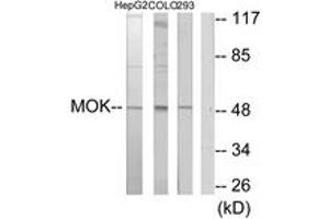 Western blot analysis of extracts from HepG2/COLO205/293 cells, using MOK Antibody. (MOK anticorps  (AA 261-310))