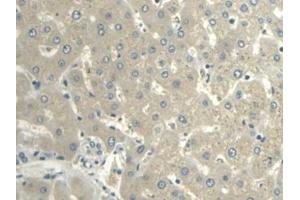 Detection of VF in Human Liver Tissue using Polyclonal Antibody to Visfatin (VF) (NAMPT anticorps  (AA 1-491))