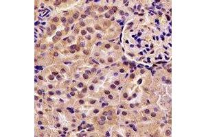 Immunohistochemical analysis of ACAA1 staining in rat kidney formalin fixed paraffin embedded tissue section. (ACAA1 anticorps)