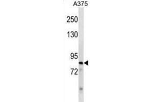 Western Blotting (WB) image for anti-Zinc Finger Protein 148 (ZNF148) antibody (ABIN3000952)