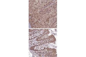 Immunohistochemical staining of human colon with TIGD7 polyclonal antibody  shows moderate cytoplasmic positivity in glandular cells. (TIGD7 anticorps)