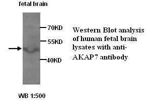 Image no. 1 for anti-A Kinase (PRKA) Anchor Protein 7 (AKAP7) antibody (ABIN1574566) (AKAP7 anticorps)