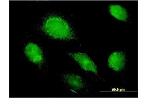 Immunofluorescence of monoclonal antibody to AMBP on HeLa cell.