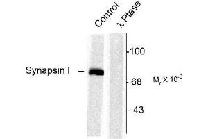 Image no. 1 for anti-Synapsin I (SYN1) (pSer603) antibody (ABIN372721) (SYN1 anticorps  (pSer603))