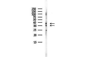 anti-Uracil-DNA Glycosylase (UNG) (Internal Region) antibody