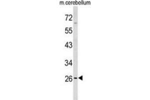 Western blot analysis of PXMP4 (arrow) in mouse cerebellum tissue lysates (35ug/lane) using PXMP4 