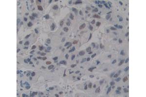 Used in DAB staining on fromalin fixed paraffin- embedded breast tissue (TDP1 anticorps  (AA 4-215))