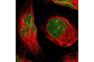 Immunofluorescent staining of U-2 OS with MINA polyclonal antibody  (Green) shows positivity in nucleus and nucleoli. (MINA anticorps)