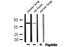 Western blot analysis of extracts from mouse lung, rat brain, using M-CK Antibody.