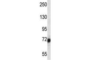 SP100 antibody western blot analysis in ZR-75-1 lysate. (SP100 anticorps  (AA 199-227))