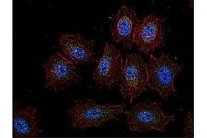 Immunocytochemistry staining of Csk in human HeLa cell line using anti-Csk (CSK-04, green).
